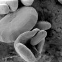 ミドリムシ（みどりむし）特有の成分であるパラミロンの顕微鏡写真